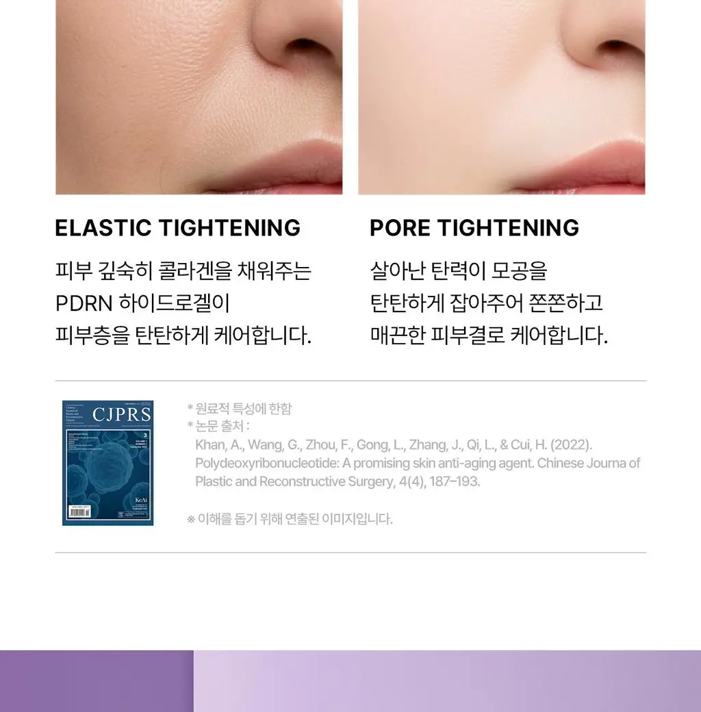 [5월 올영픽/9중 모공지표 개선/올리브영 단독 런칭] 리쥬란 더마 힐러 포어 타이트닝 겔 마스크 5매 상세페이지 12